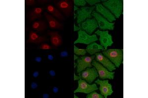 ABIN6257185 and ABIN6274308 staining Hela cells by IF/ICC. (Foxk1 抗体  (Internal Region))