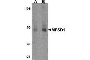 Western blot analysis of MFSD1 in human lung tissue lysate with MFSD1 antibody at (A) 1 and (B) 2 μg/ml. (MFSD1 抗体  (Center))