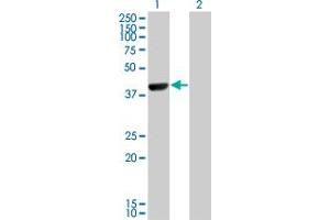 Western Blot analysis of CAMK1D expression in transfected 293T cell line by CAMK1D monoclonal antibody (M10), clone 3H8. (CAMK1D 抗体  (AA 1-95))