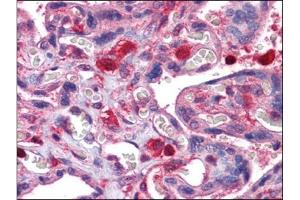 Human Placenta: Formalin-Fixed, Paraffin-Embedded (FFPE) (GDI2 抗体)