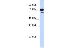 R3HDM2 antibody used at 1 ug/ml to detect target protein. (R3HDM2 抗体  (Middle Region))