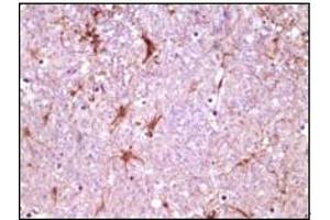 Immunohistochemistry (IHC) image for anti-Calcium and Integrin-Binding Protein 1 (CIB1) (truncated) antibody (ABIN2464036) (CIB1 抗体  (truncated))