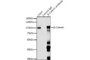 Immunoprecipitation (IP) image for anti-Catenin (Cadherin-Associated Protein), beta 1, 88kDa (CTNNB1) (AA 1-100) antibody (ABIN6139205)