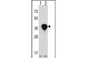 Western blot analysis of TALDO1 (arrow) using rabbit polyclonal TALDO1 Antibody (Center) (ABIN390629 and ABIN2840933).