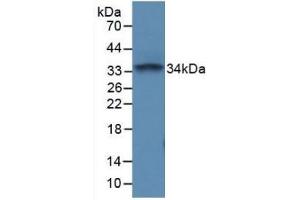 Detection of Recombinant PTPRC, Mouse using Polyclonal Antibody to Protein Tyrosine Phosphatase Receptor Type C (CD45) (CD45 抗体  (AA 371-556))