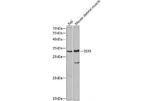 Western blot analysis of extracts of various cell lines using SSX5 Polyclonal Antibody at dilution of 1:1000. (SSX5 抗体)