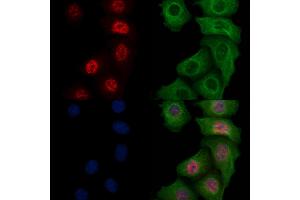 ABIN6256764 and ABIN6267179 staining heat-shock treated Hela cells by IF/ICC. (SHP1 抗体  (pTyr564))