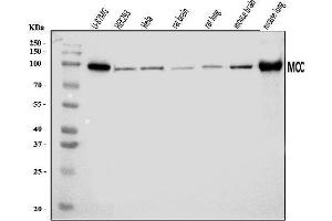 Western blot analysis of MCC using anti-MCC antibody (ABIN7599132).