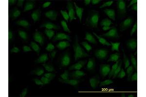 Immunofluorescence (IF) image for anti-Decapping Enzyme, Scavenger (DCPS) (AA 1-337) antibody (ABIN526020)