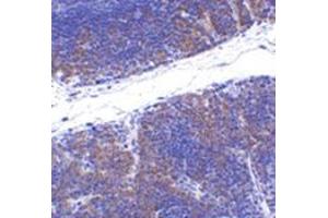 Immunohistochemistry of TNFRSF14 in mouse thymus tissue with this product at 1 μg/ml.