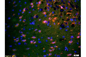 Formalin-fixed and paraffin embedded rat brain labeled with Anti-SPR Polyclonal Antibody, Unconjugated (ABIN724385) 1:200 followed by conjugation to the secondary antibody and DAB staining (TACR1 抗体  (AA 2-50))