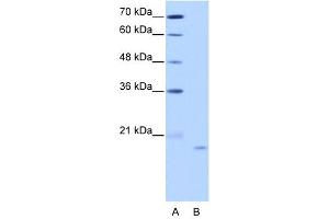 NOL6 antibody used at 2. (Nucleolar Protein 6 抗体)