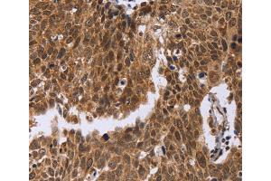 Immunohistochemistry (IHC) image for anti-Excision Repair Cross-Complementing Rodent Repair Deficiency, Complementation Group 6-Like (ERCC6L) antibody (ABIN2423389) (ERCC6L 抗体)