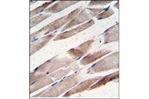 Image no. 1 for anti-Desmin (DES) antibody (ABIN357901) (Desmin 抗体)