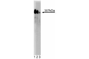 Western blot analysis of Mitosin on a Jurkat cell lysate (Human T-cell leukemia, ATCC TIB-152). (CENPF 抗体  (AA 209-381))