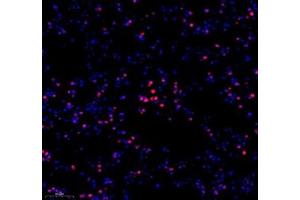 Immunofluorescence of paraffin embedded mouse lung using hmgn1 (ABIN7074222) at dilution of 1: 1000 (250x lens) (HMGN1 抗体)