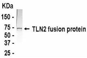 Western Blotting (WB) image for anti-Talin 2 (TLN2) (AA 1750-1950) antibody (ABIN2467893) (TLN2 抗体  (AA 1750-1950))
