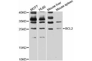 Western blot analysis of extracts of various cell lines, using BCL2 antibody (ABIN6291793) at 1:1000 dilution. (Bcl-2 抗体)