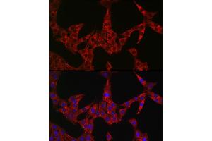 Immunofluorescence analysis of PC-12 cells using GSDME antibody (ABIN6127757, ABIN6139554, ABIN6139555 and ABIN6223304) at dilution of 1:50. (Non-Syndromic Hearing Impairment Protein 5 (GSDME) (AA 1-260) 抗体)