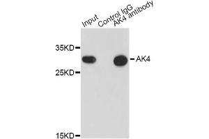 Immunoprecipitation analysis of 200ug extracts of HepG2 cells using 0. (AK4 抗体)