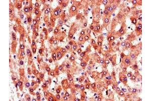 Immunohistochemistry of paraffin-embedded human liver tissue using ABIN7164866 at dilution of 1:100 (PTGR1 抗体  (AA 202-282))