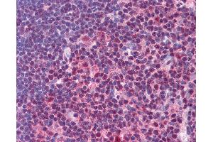 Immunohistochemistry (IHC) image for anti-Signal Transducer and Activator of Transcription 3 (Acute-Phase Response Factor) (STAT3) (AA 683-732) antibody (ABIN604780)