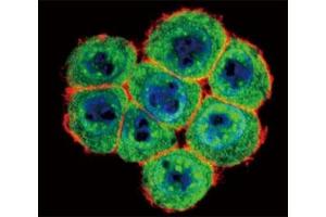 Confocal immunofluorescent analysis of SMAD4 antibody with HeLa cells followed by Alexa Fluor 488-conjugated goat anti-rabbit lgG (green). (SMAD4 抗体  (AA 255-284))