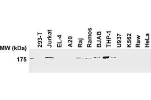 Western blot analysis of human and mouse cell lines using anti-human NLRP1/NALP1 antibody (AL176) . (NLRP1 抗体  (N-Term))