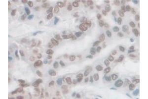 Immunohistochemistry (IHC) image for anti-Proprotein Convertase Subtilisin/kexin Type 1 (PCSK1) (AA 500-738) antibody (ABIN7435748)