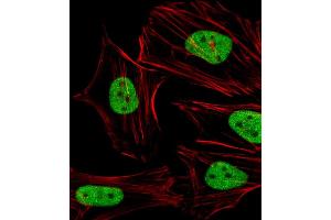 Immunofluorescence (IF) image for anti-Signal Transducer and Activator of Transcription 5A (STAT5A) (AA 730-765), (C-Term) antibody (ABIN6242560)