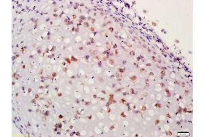 Formalin-fixed and paraffin embedded mouse embryo labeled with Anti-Aggrecan1 Polyclonal Antibody, Unconjugated (ABIN673599) at 1:200 followed by conjugation to the secondary antibody and DAB staining (Aggrecan 抗体  (AA 101-220))