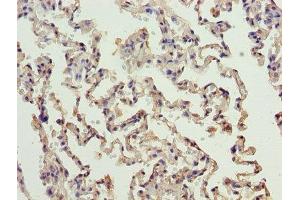 Immunohistochemistry of paraffin-embedded human lung tissue using ABIN7150172 at dilution of 1:100