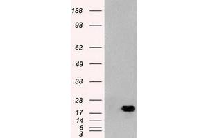 HEK293T cells were transfected with the pCMV6-ENTRY control (Left lane) or pCMV6-ENTRY AK1 (Right lane) cDNA for 48 hrs and lysed. (Adenylate Kinase 1 抗体)