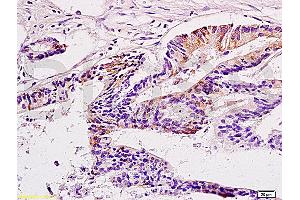 Immunohistochemistry (IHC) image for anti-Cancer/testis Antigen 2 (CTAG2) (AA 121-210) antibody (ABIN721135)