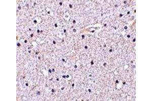 Immunohistochemistry (IHC) image for anti-Nicastrin (NCSTN) (C-Term) antibody (ABIN1030543) (Nicastrin 抗体  (C-Term))