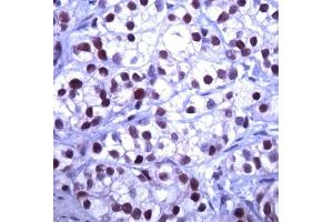 Immunohistochemistry (Paraffin-embedded Sections) (IHC (p)) image for anti-S-Phase Kinase-Associated Protein 2 (SKP2) (AA 221-425) antibody (ABIN5611444)