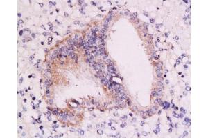 Formalin-fixed and paraffin embedded: human endometrium tissue labeled with Anti-RAR-alpha Polyclonal Antibody, Unconjugated at 1:200, followed by conjugation to the secondary antibody and DAB staining (Retinoic Acid Receptor alpha 抗体  (AA 361-462))