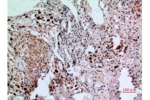 Immunohistochemistry (IHC) analysis of paraffin-embedded Human Lung, antibody was diluted at 1:100. (NFATC1 抗体  (C-Term))