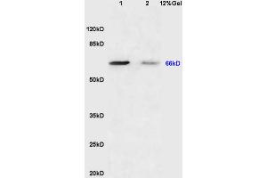 Lane 1: mouse brain lysates Lane 2: mouse lung lysates probed with Anti Sema7A/CD108 Polyclonal Antibody, Unconjugated (ABIN749363) at 1:200 in 4 °C. (SEMA7A 抗体  (AA 351-450))