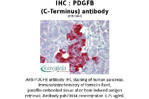 Image no. 1 for anti-Platelet Derived Growth Factor Subunit B (PDGFB) (C-Term) antibody (ABIN1737934) (PDGFB 抗体  (C-Term))