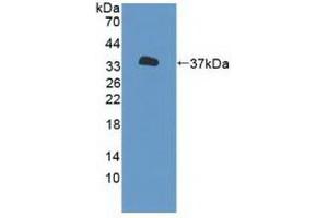 Detection of Recombinant P2RX7, Human using Polyclonal Antibody to Purinergic Receptor P2X, Ligand Gated Ion Channel 7 (P2RX7) (P2RX7 抗体  (AA 47-334))