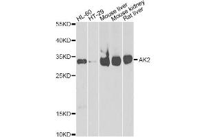 Western blot analysis of extracts of various cell lines, using AK2 antibody (ABIN2560999) at 1:1000 dilution. (Adenylate Kinase 2 抗体)