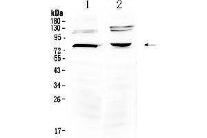 Western blot analysis of Dishevelled 3 using anti- Dishevelled 3 antibody . (DVL3 抗体  (Middle Region))