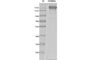 Recombinant JARID1A / KDM5A protein gel. (KDM5A Protein (DYKDDDDK Tag))