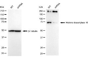 Western blotting analysis using histone deacetylase 10 antibody (ABIN7798926). (Recombinant HDAC10 抗体)