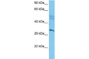 Western Blotting (WB) image for anti-Cyclin-Dependent Kinase 5 (CDK5) (C-Term) antibody (ABIN2780626)