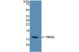 Detection of Recombinant MRP1, Rat using Polyclonal Antibody to Chemokine (C-C motif) ligand 6 (CCL6) (CCL6 抗体  (AA 21-115))