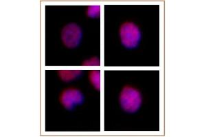 anti-MEIS1/MEIS2/MEIS3 (AA 50-390) antibody