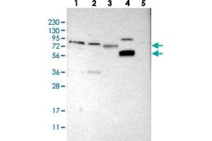 Western blot analysis of Lane 1: RT-4, Lane 2: U-251 MG, Lane 3: Human Plasma, Lane 4: Liver, Lane 5: Tonsil with FRRS1 polyclonal antibody . (Ferric-Chelate Reductase 1 (FRRS1) 抗体)