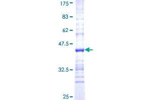 Image no. 1 for 5,10-Methenyltetrahydrofolate Synthetase (5-Formyltetrahydrofolate Cyclo-Ligase) (MTHFS) (AA 104-203) protein (GST tag) (ABIN2752863) (MTHFS Protein (AA 104-203) (GST tag))